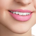 EN EL AUMENTO DE LABIOS, NO TODO VALE, con Helga Rivera