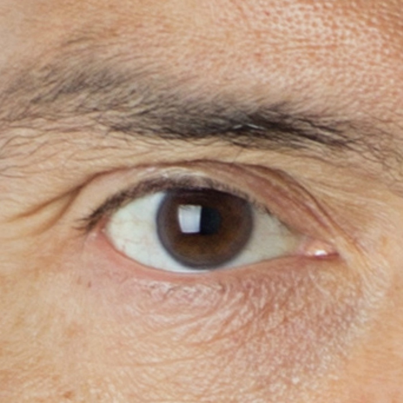 Ojo de Pez