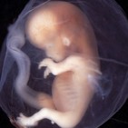 VENTANA ABIERTA: Aborto y eutanasia