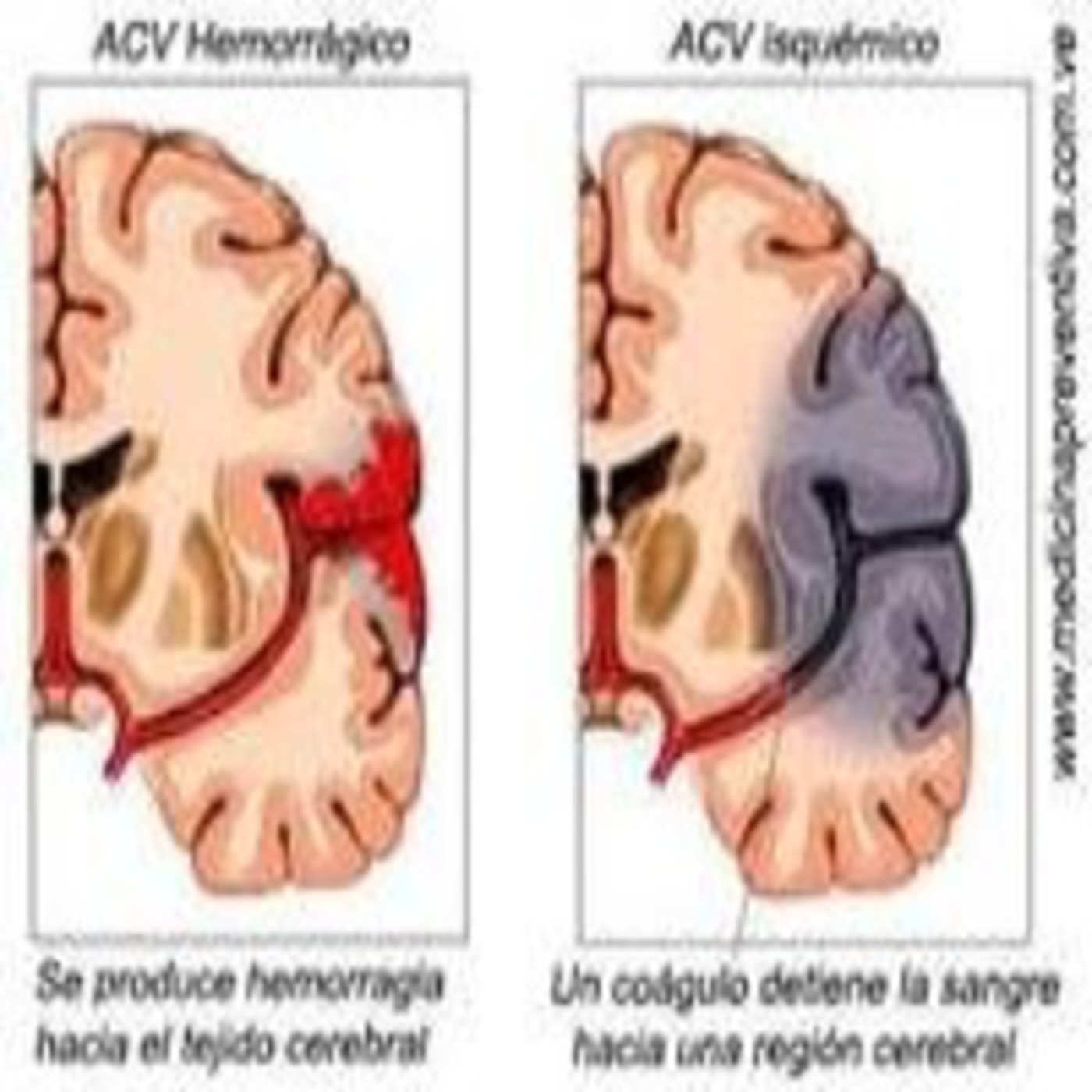 HABLEMOS DE SALUD... TEMAS PARA UNA VIDA MEJOR