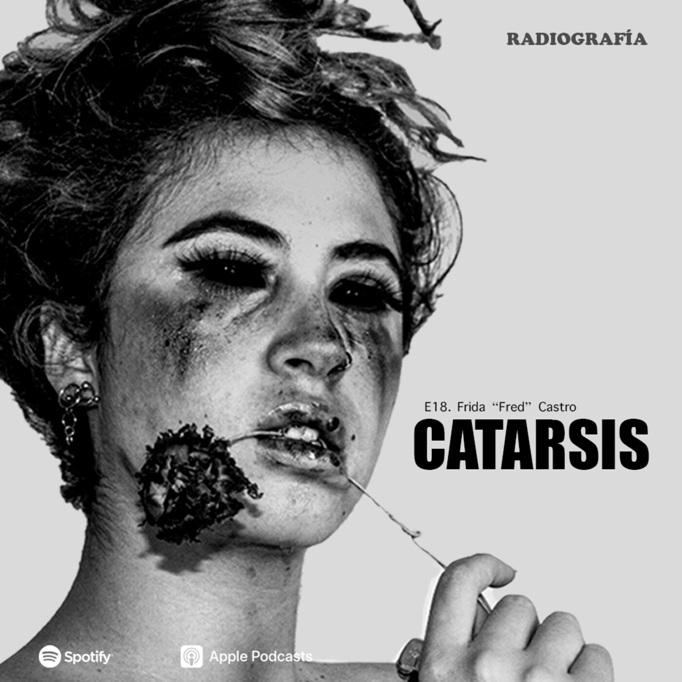RADIOGRAFÍA