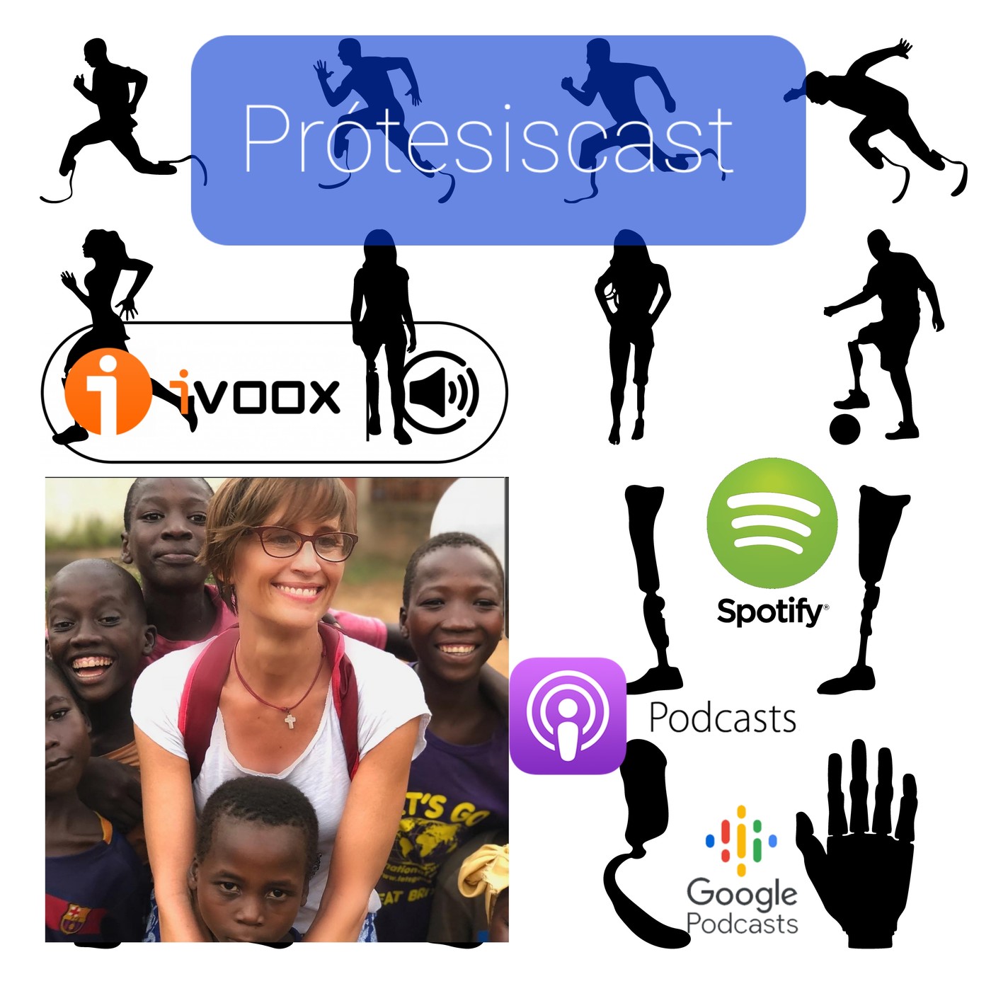 Protesiscast