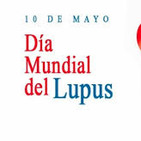 Saludario. Temp 5. 30. Lupus, cefaleas en racimos y salud cardiovascular.