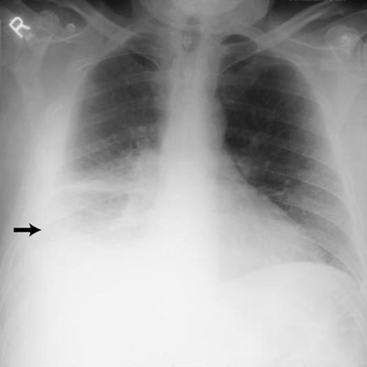 Diagnosticofisico UNASA