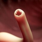 #218 Parasite por Raelana Sagan