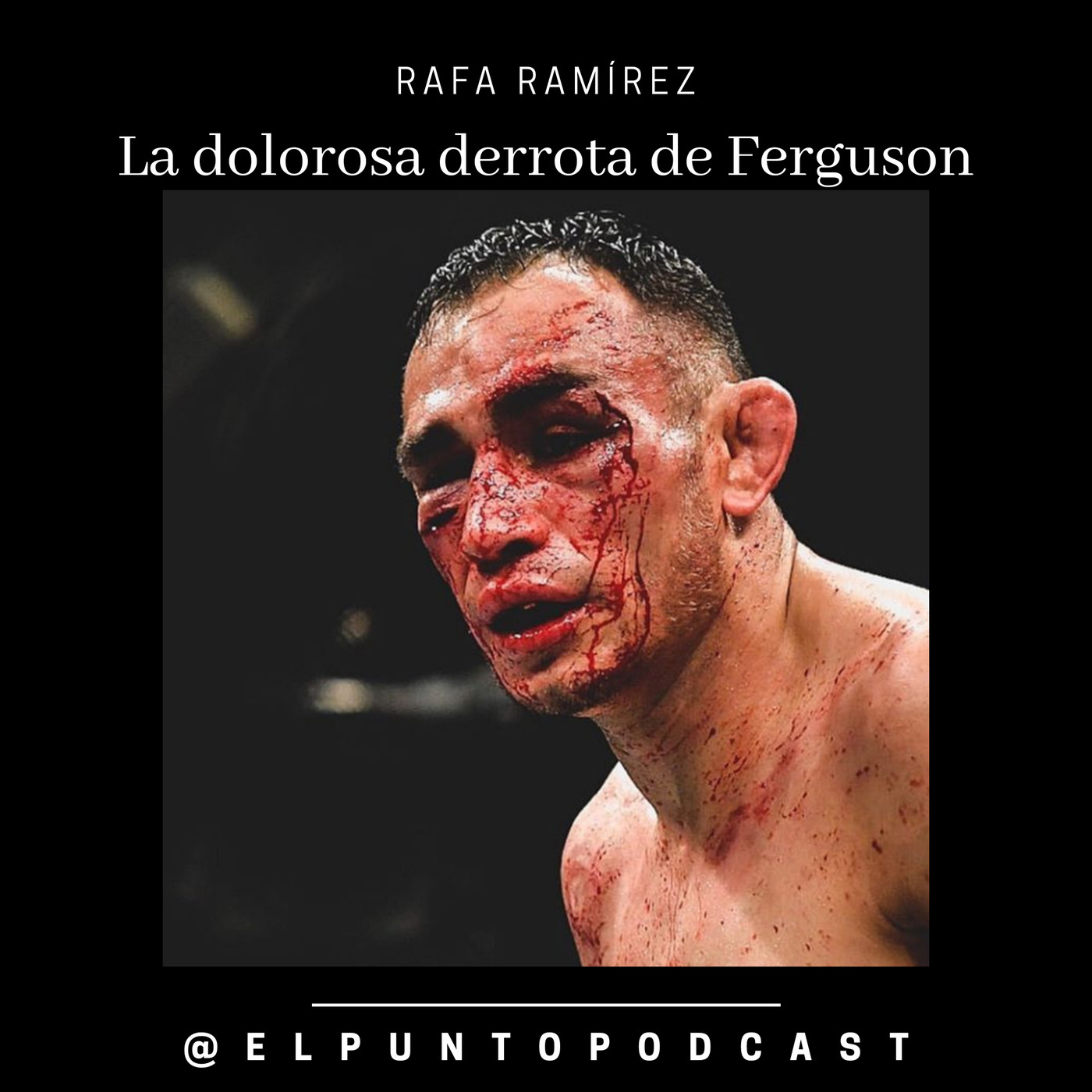 UFC La dolorosa derrota de Tony Ferguson episode artwork