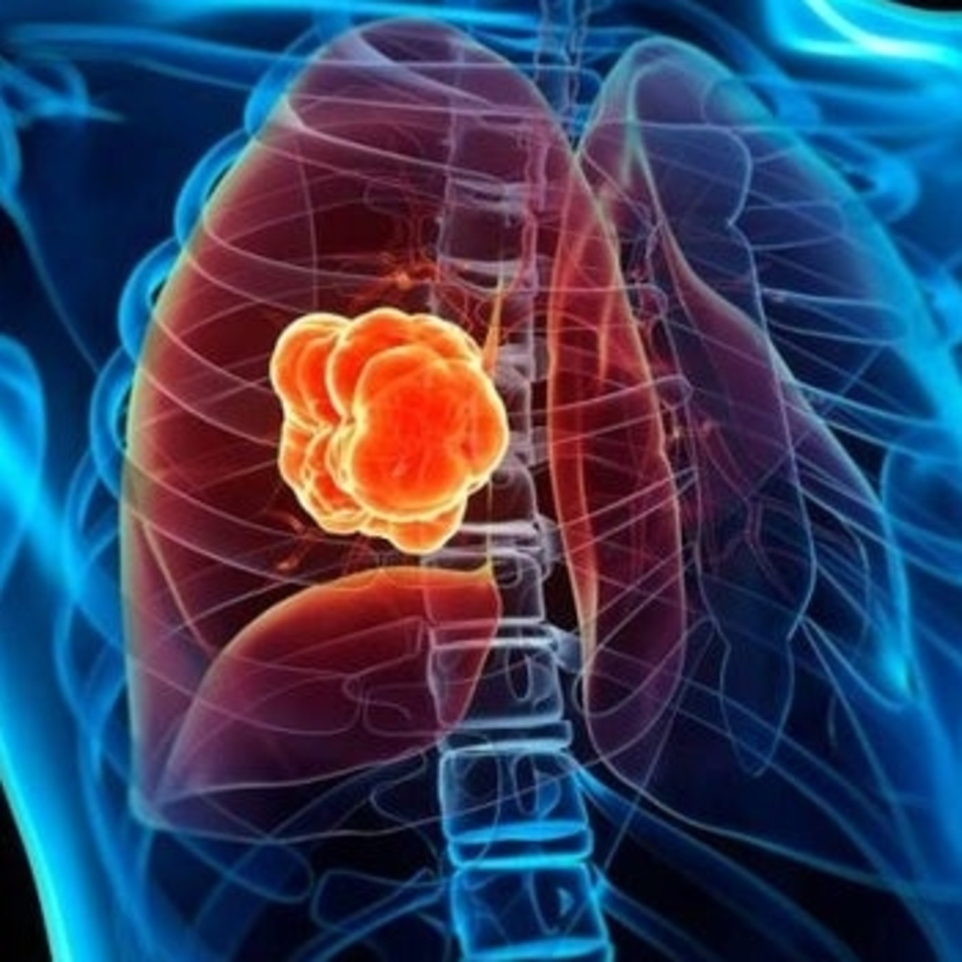 Células troncales y cáncer