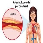 Diabetes en Radio 055 – El Colesterol y la diabetes