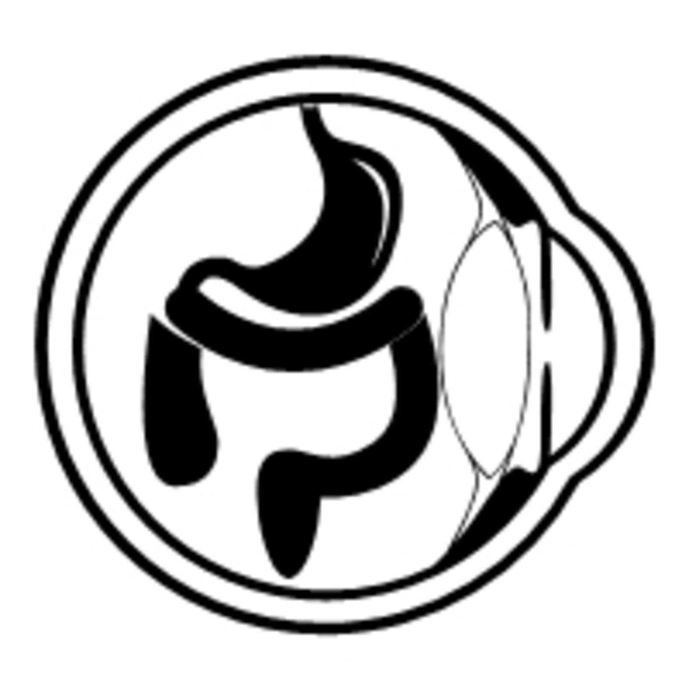 Alta incidencia de neoplasia avanzada durante el seguimiento de pacientes con Síndrome de Poliposis Serrada