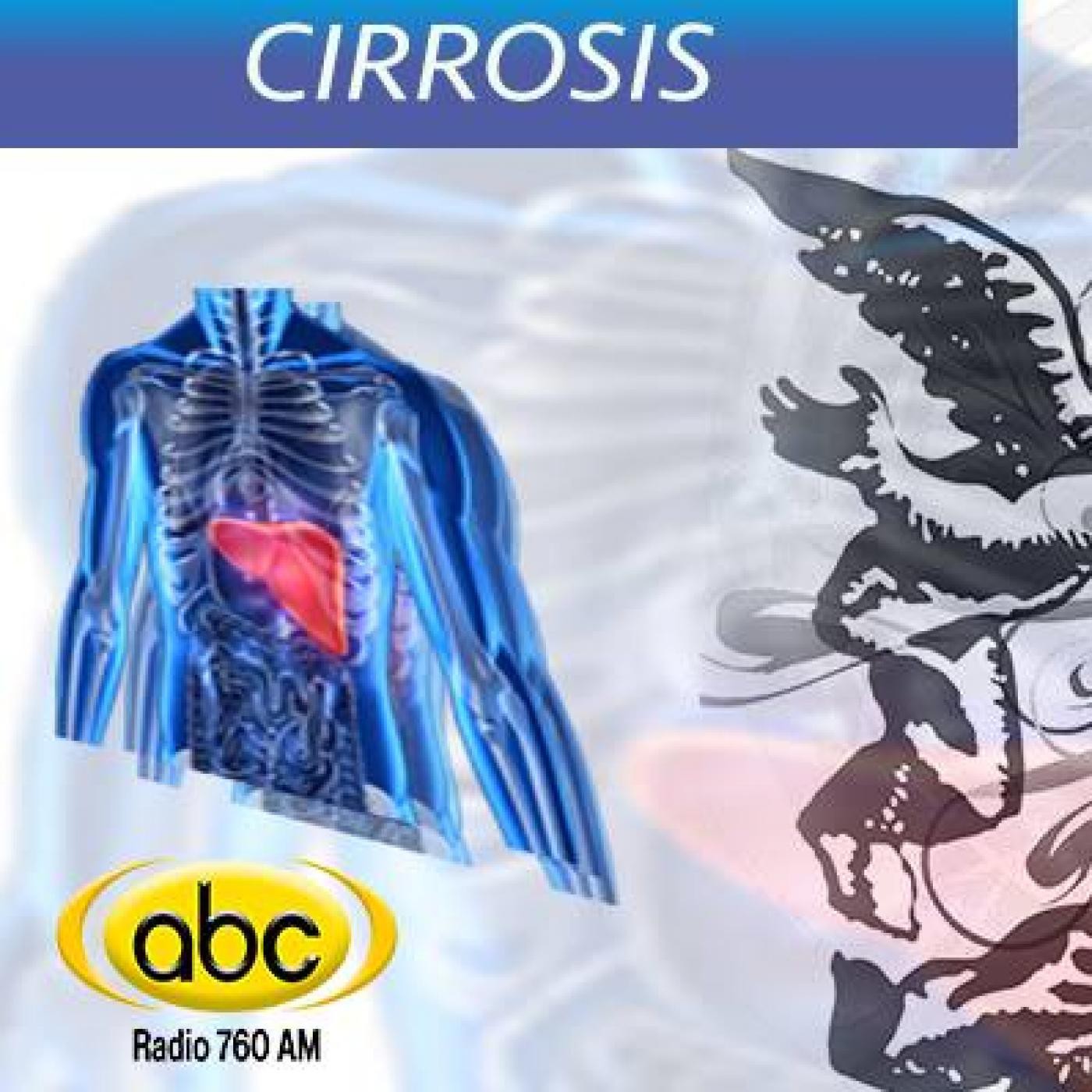 EL ÁNGEL DE TU SALUD- Rodrigo Mondragón - CIRROSIS episode artwork
