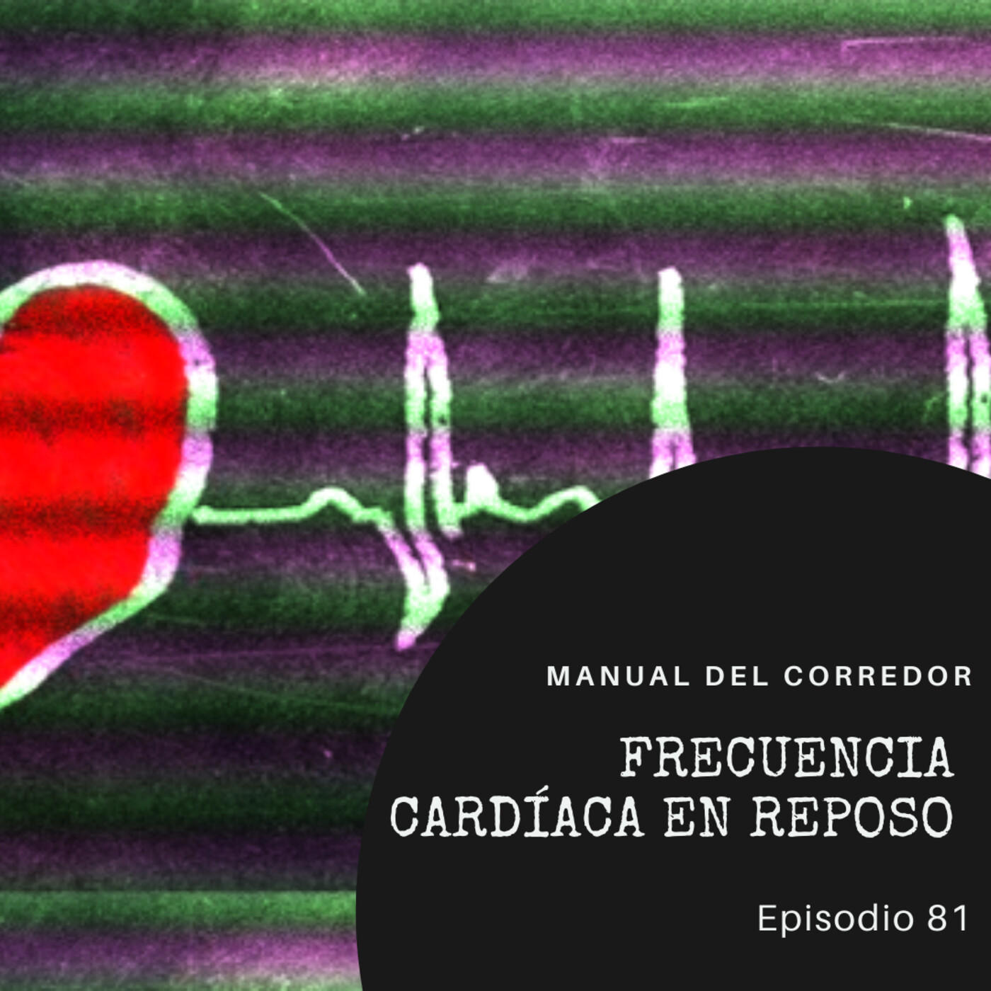 81. Frecuencia cardíaca en reposo
