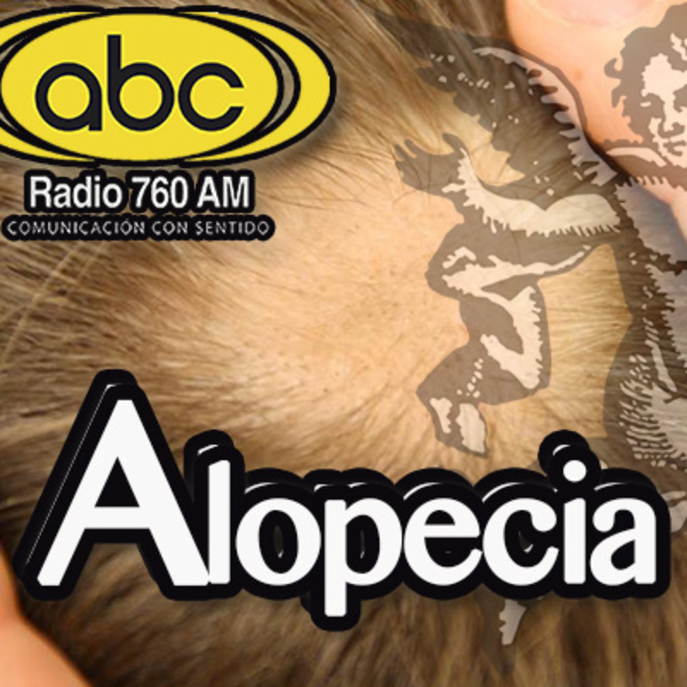 El Angel de tu Salud - ALOPECIA episode artwork