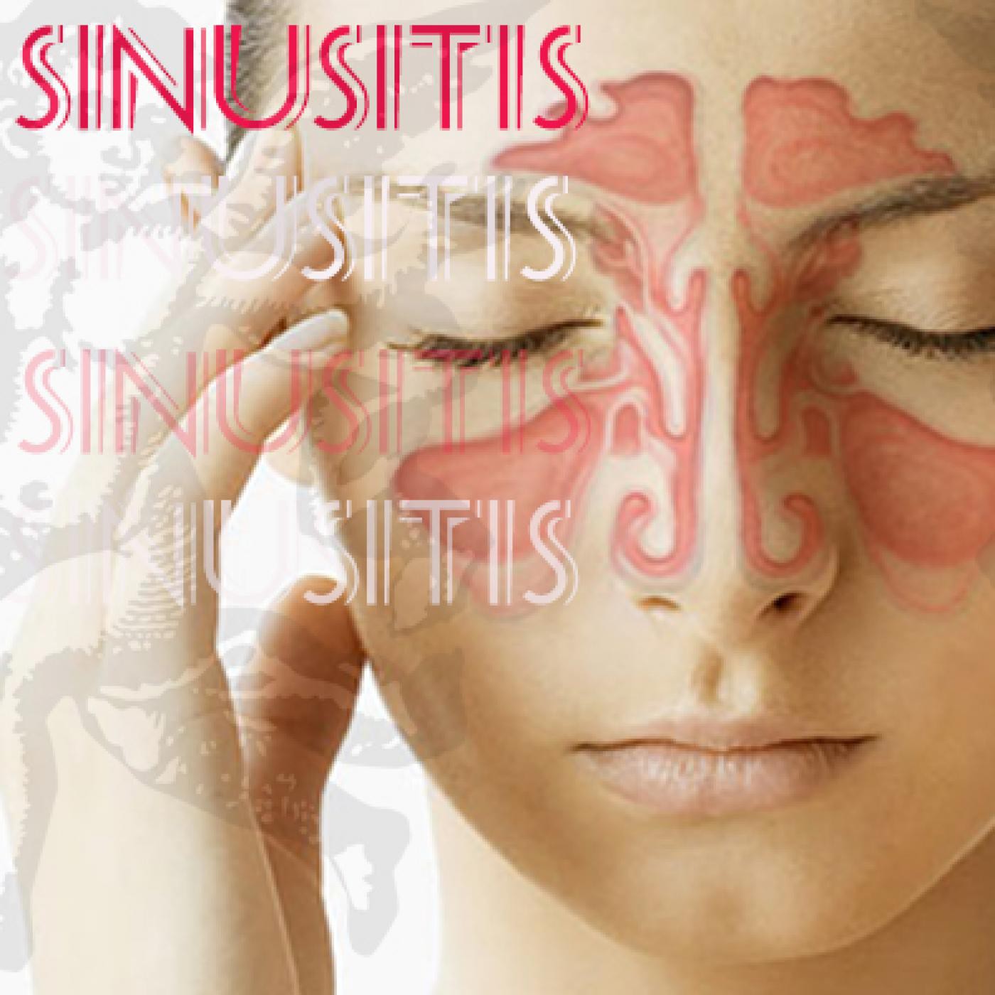 EL ÁNGEL DE TU SALUD- Rodrigo Mondragón - SINUSITIS episode artwork