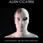 Corrado Malanga (Audio mejorado)- Alien Cicatrix (Psicologia de los fenomenos de abduccion)
