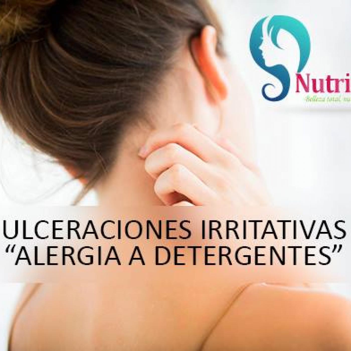Nutribella 29/01/2016 - ULCERACIONES IRRITATIVAS episode artwork
