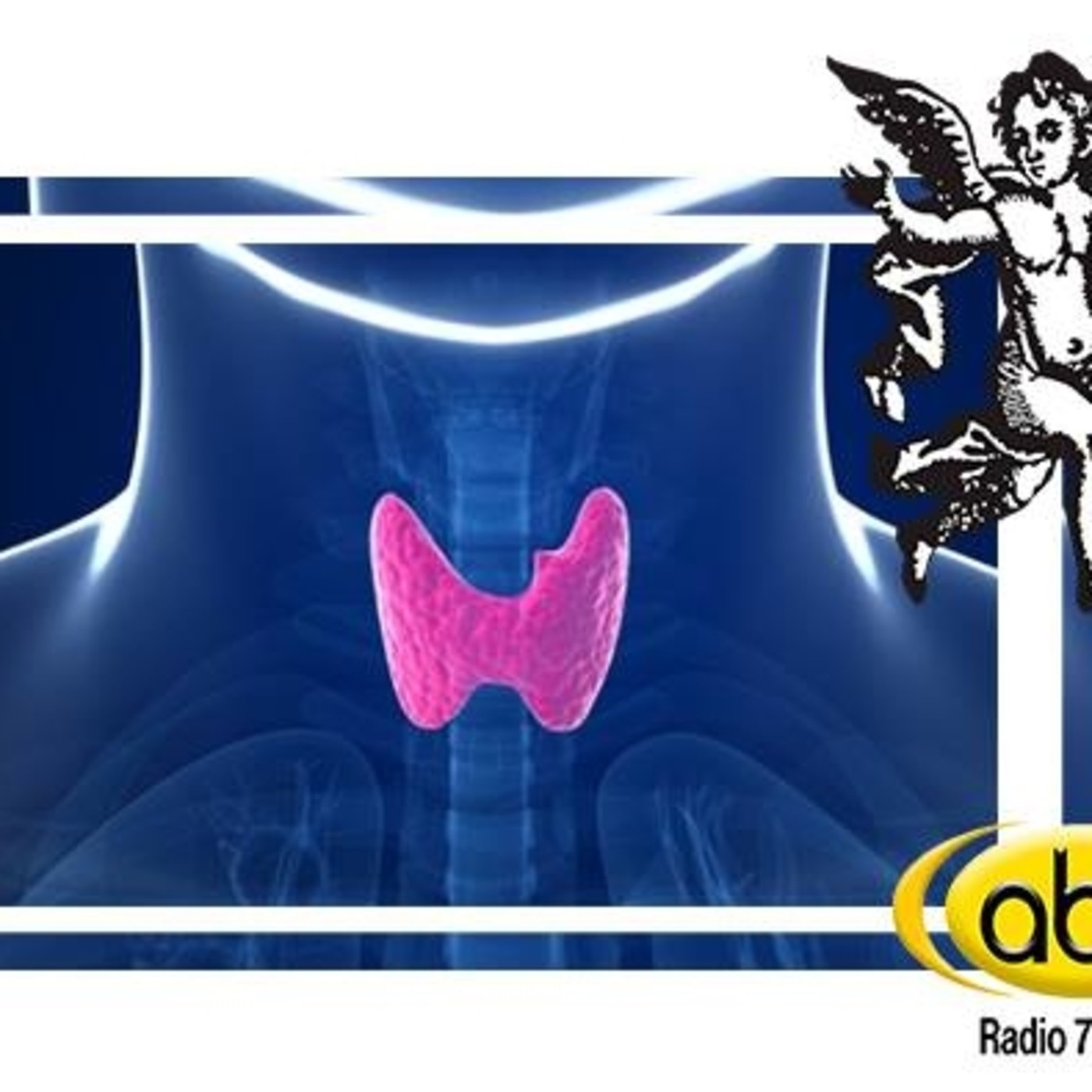 El Ángel de tu salud - HIPERTIROIDISMO