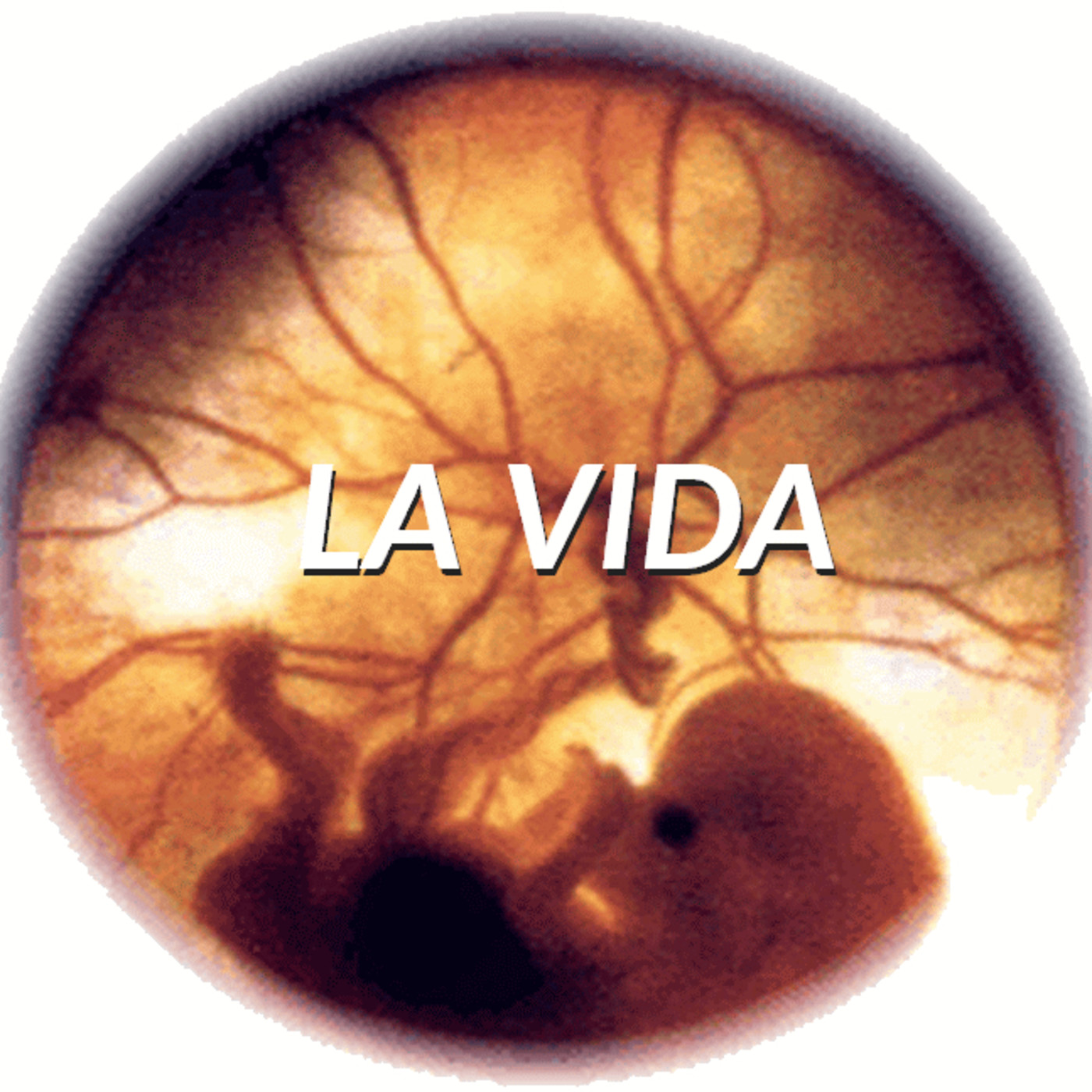 Audio Poemas de Tere Matthews