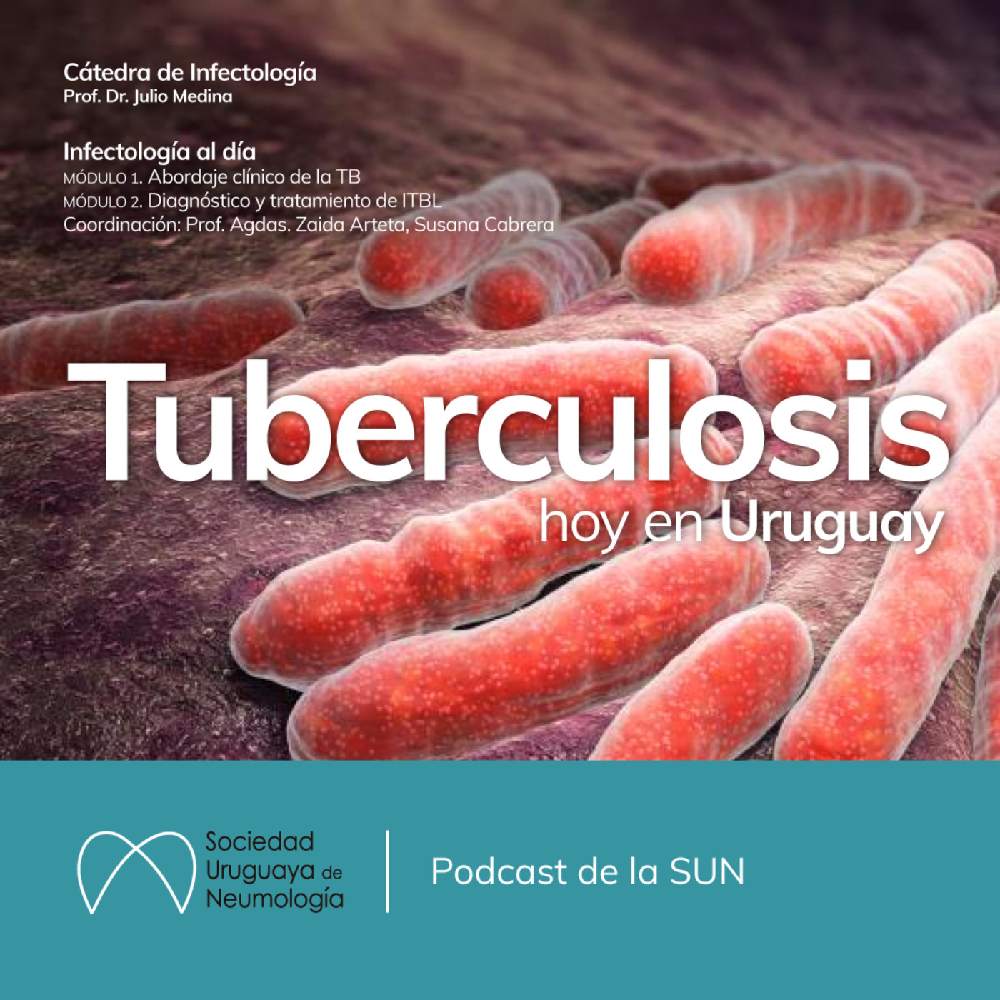 SUNeumología