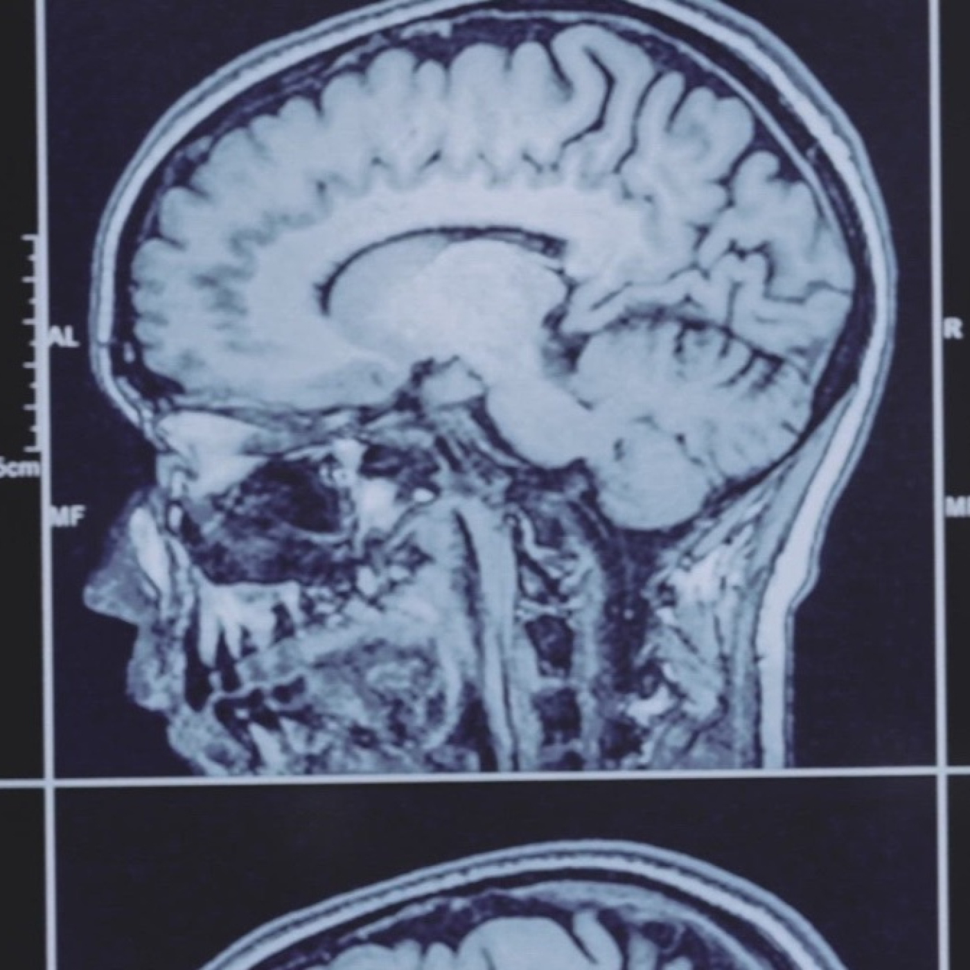 Lo inexplicable T6: Descifrando el sexto sentido