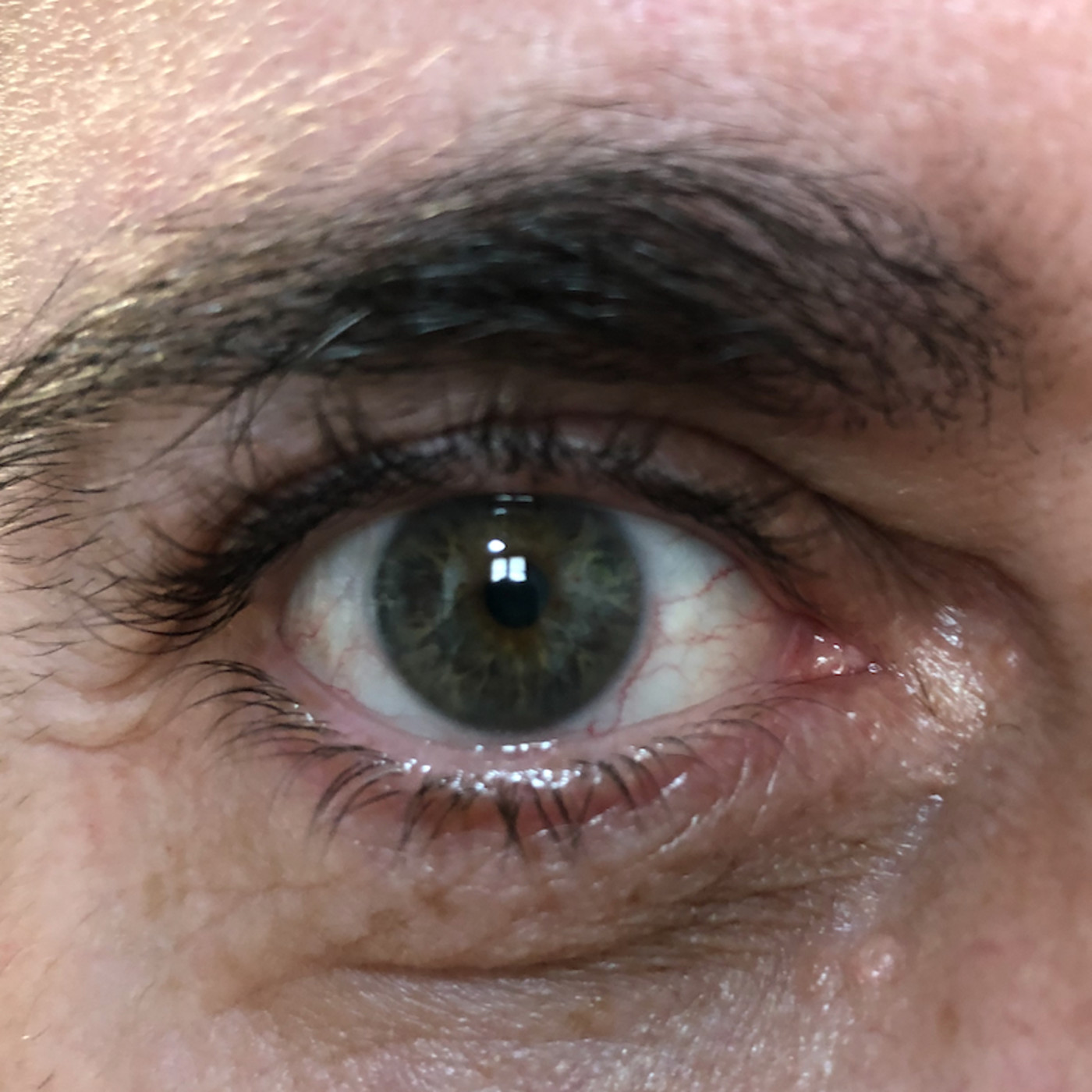 Ojo de Pez