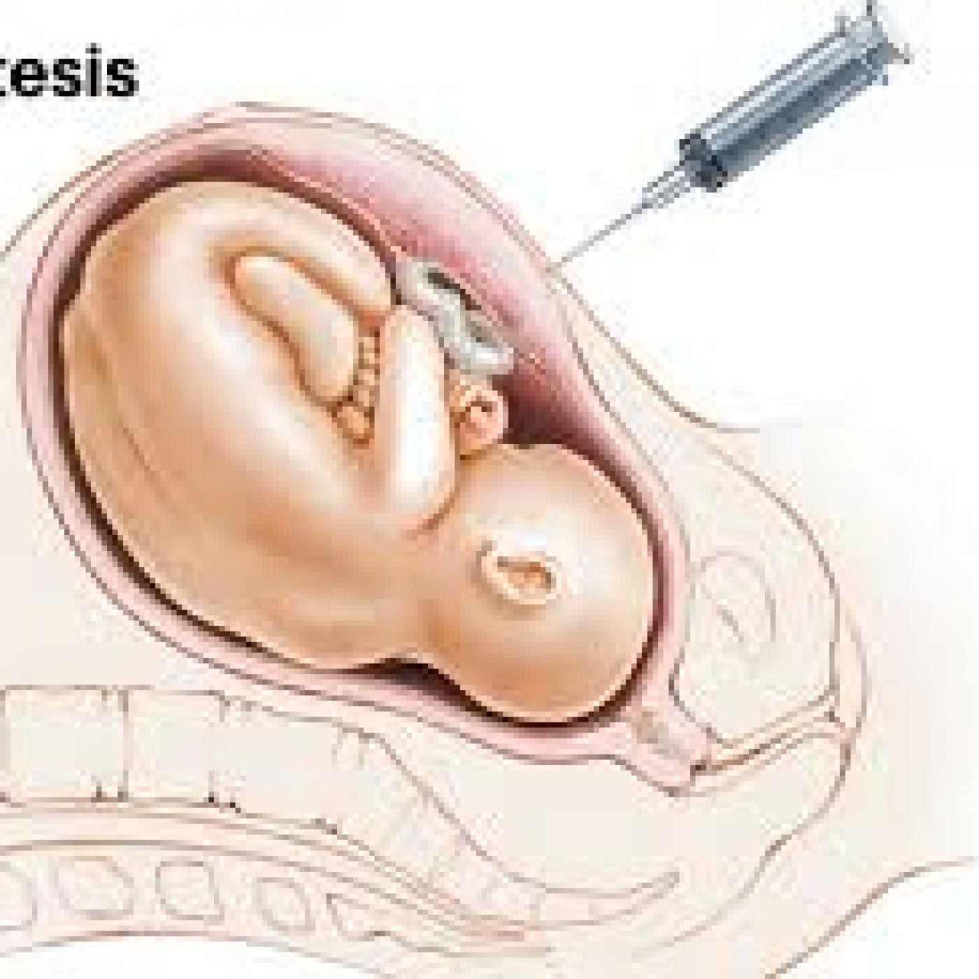TEST DE DETECCIÓN PRENATAL DE ANOMALÍAS GENÉTICAS EN SANGRE MATERNA. episode artwork