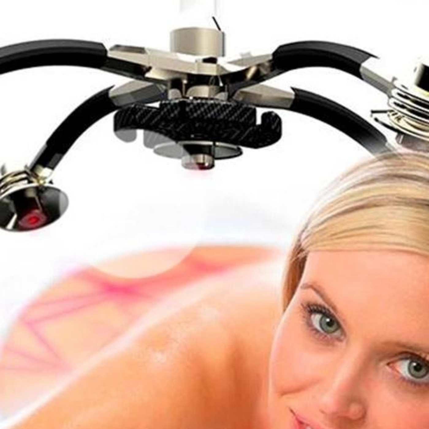 Medicina estética, Laser Zerona