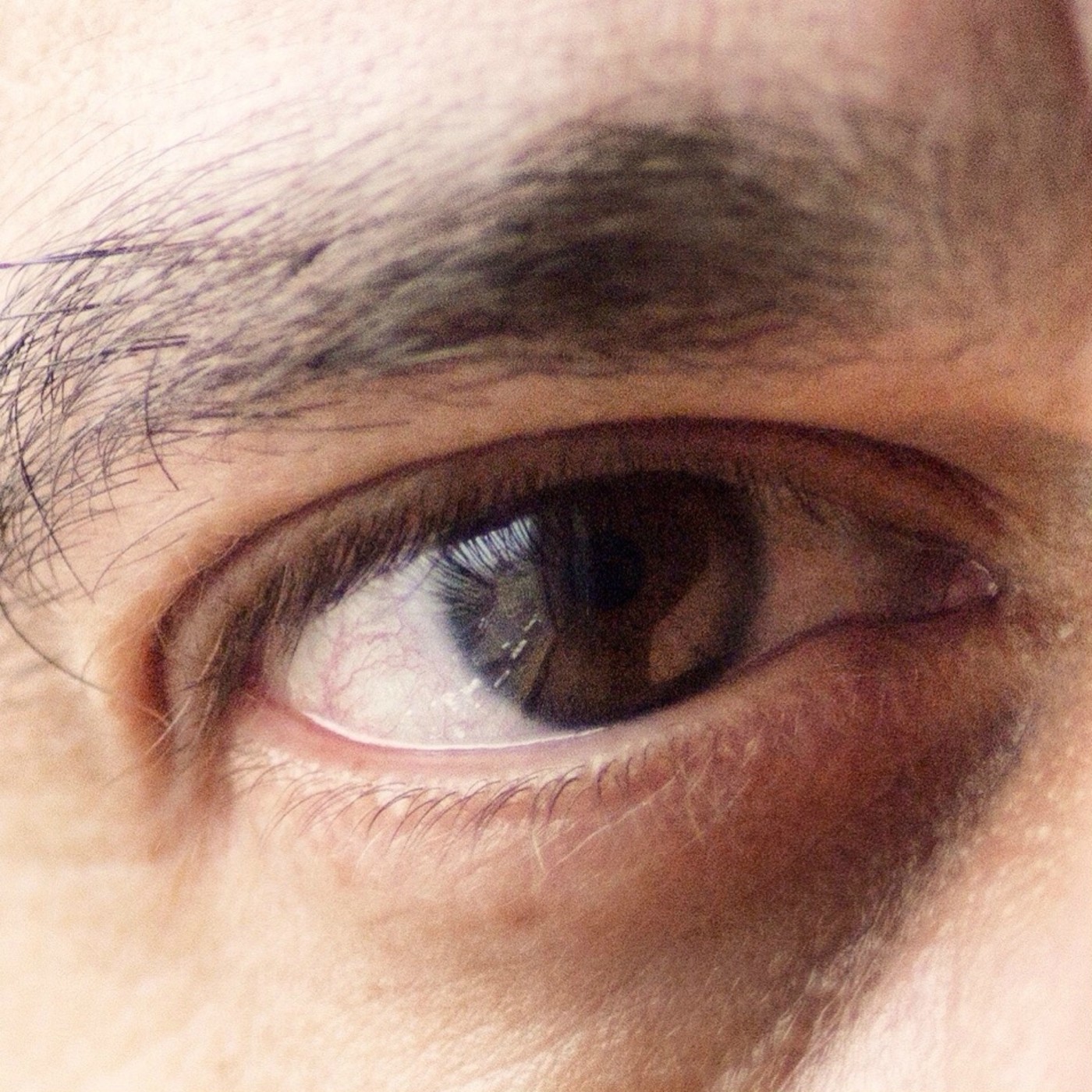 Ojo de Pez