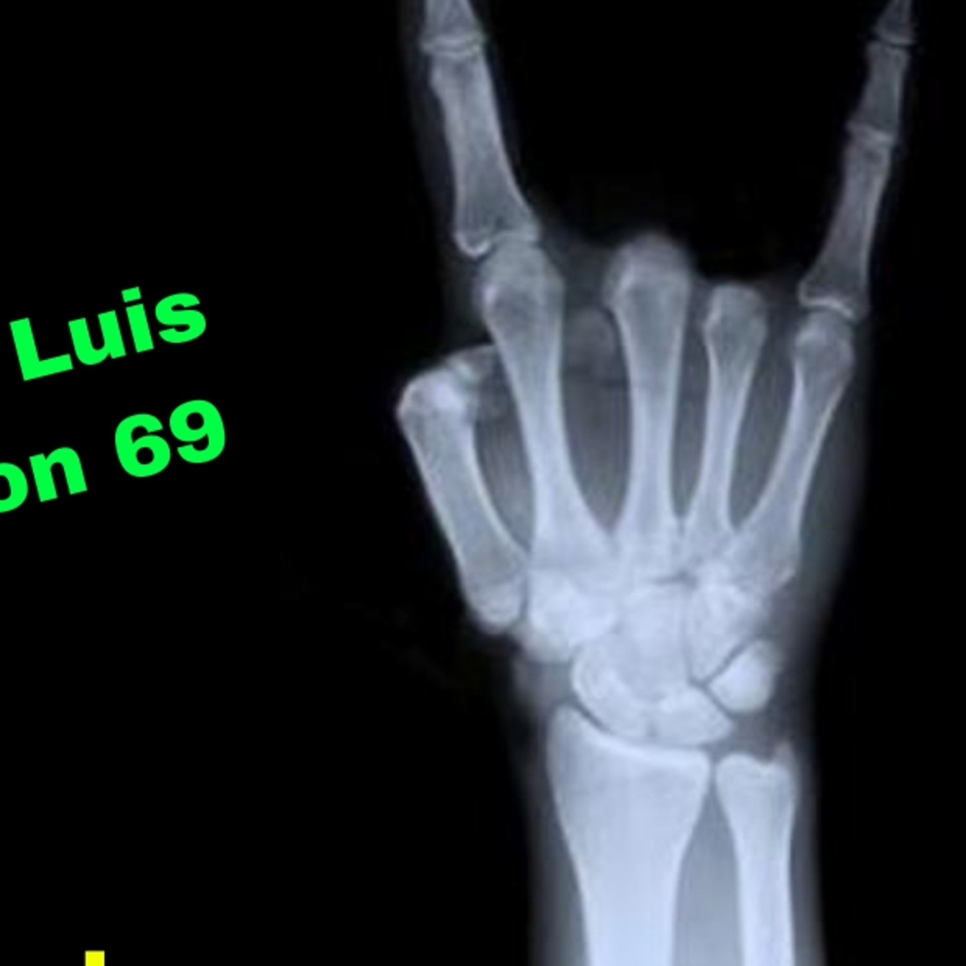 Tondi Summer Time Revolution 69. "El Cuerpo Humano". episode artwork