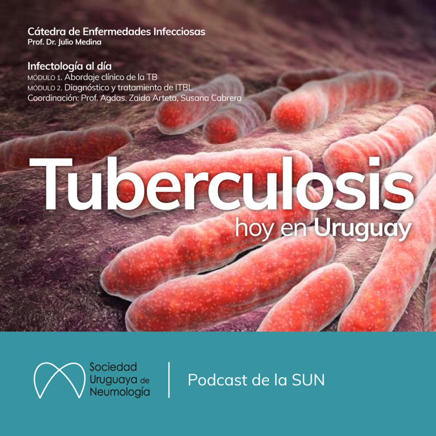 SUNeumología
