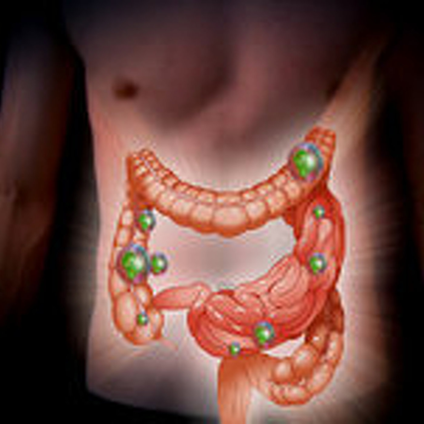 El colon. Parte 3 episode artwork