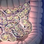 Sobrecrecimiento Bacteriano (SIBO), Síndrome del Intestino Irritable, Intolerancia a la fructosa, FODMAP y más