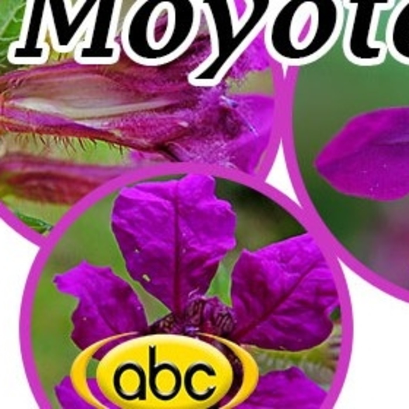 El Ángel de tu Salud - MOYOTE episode artwork