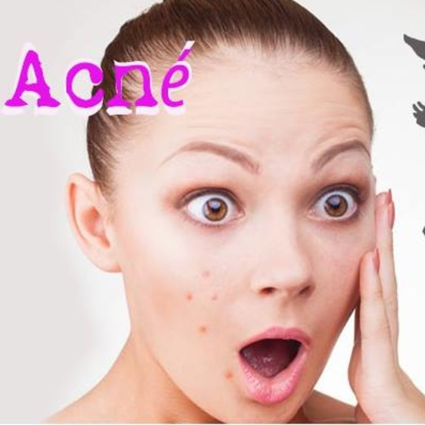 El Ángel de tu salud - ACNE episode artwork