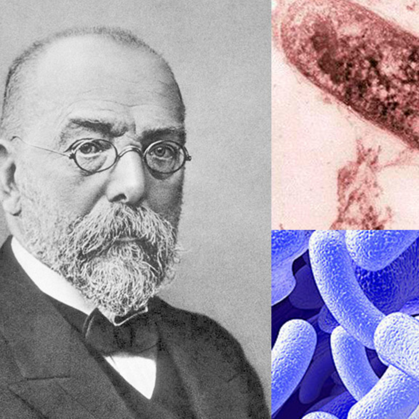 ¿A qué no sabias quien descubrió la cura de la tuberculosis?
