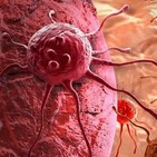 Ayuno intermitente y cetosis contra el cáncer