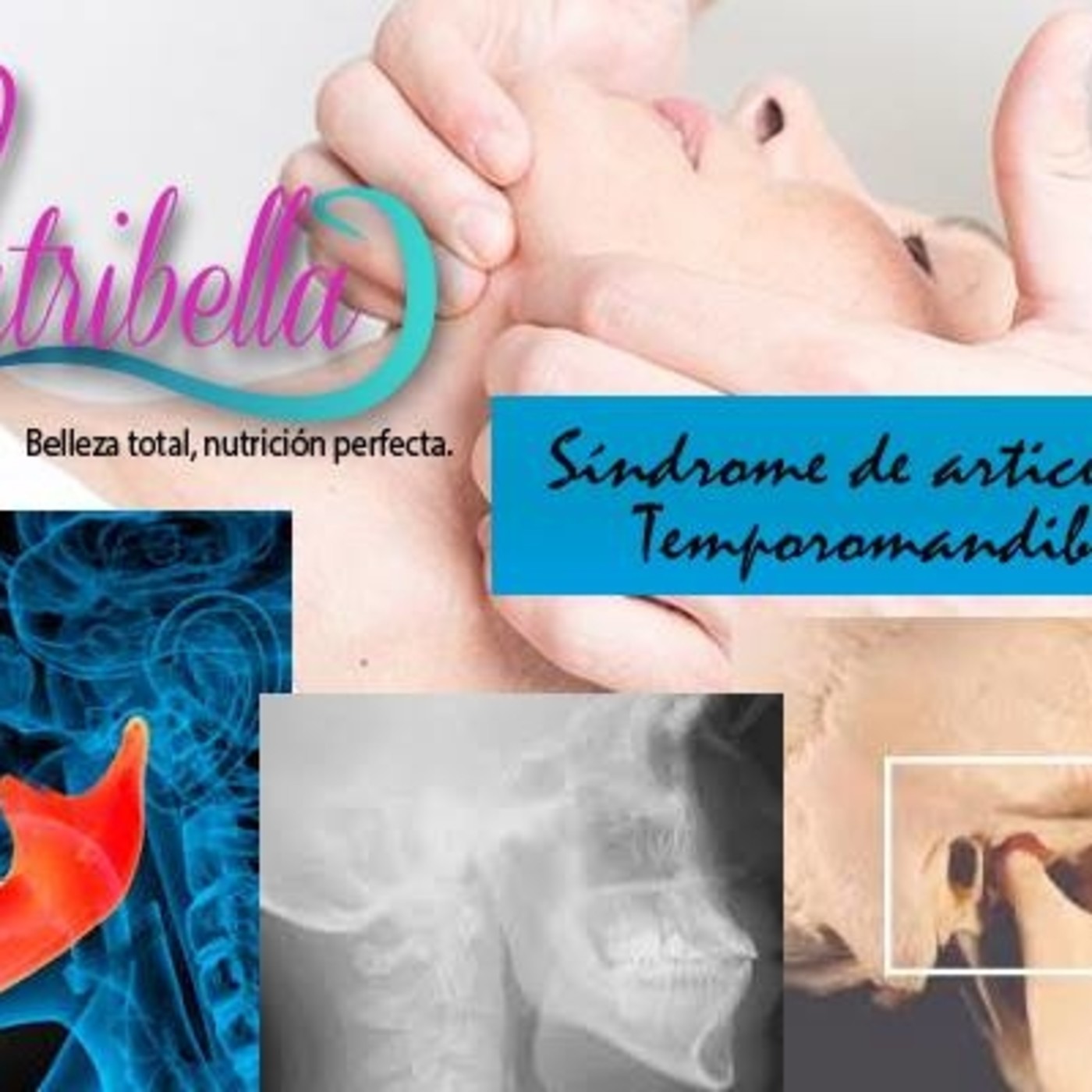 Nutribella - SÍNDROME DE ARTICULACIÓN TEMPOROMANDIBULAR
