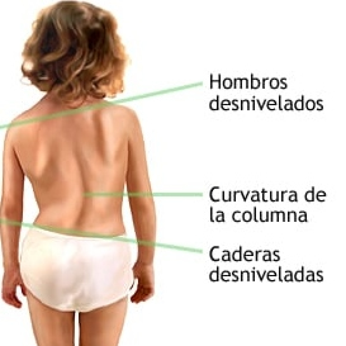 Fisioterapia. La escoliosis episode artwork