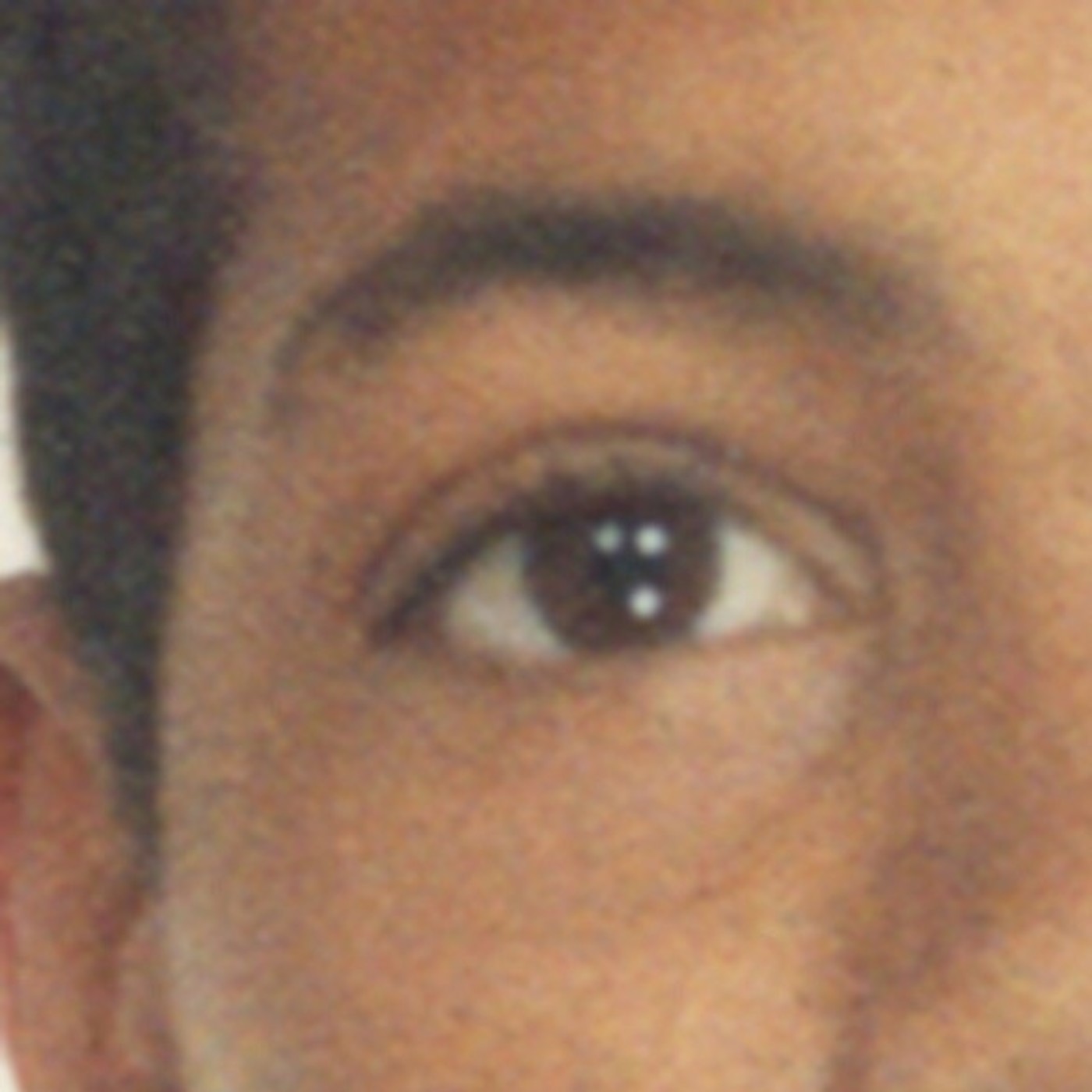 Ojo de Pez
