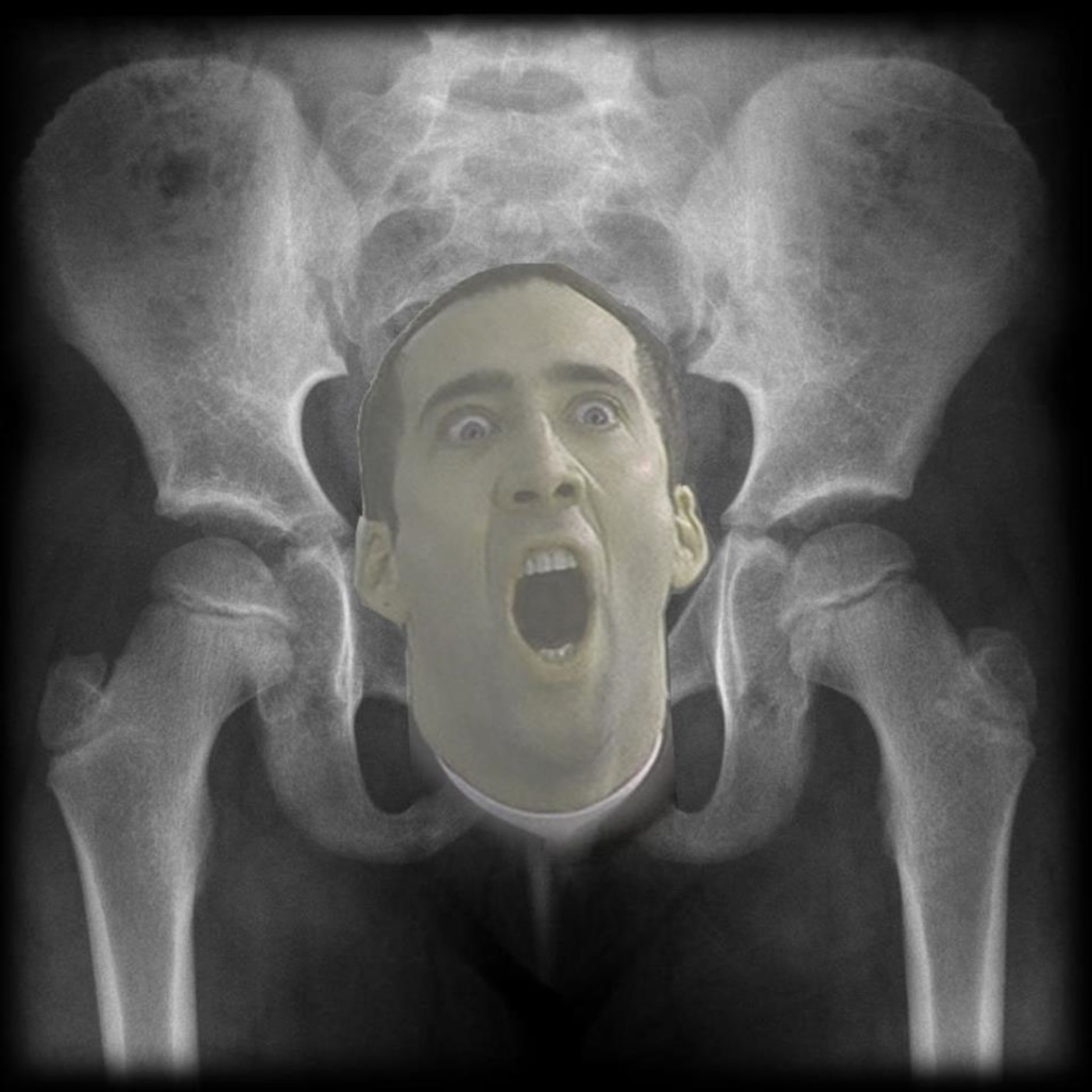 El flequillo de Nicolas Cage
