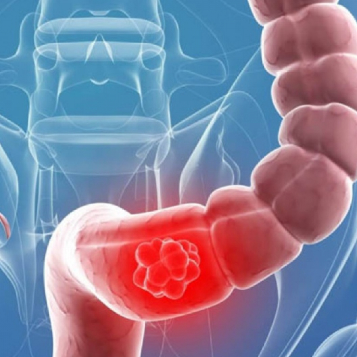 0:22 / 19:35 Cáncer de colon - Alcarria TV – Al Médico con Ramón – 2022-03-08 episode artwork