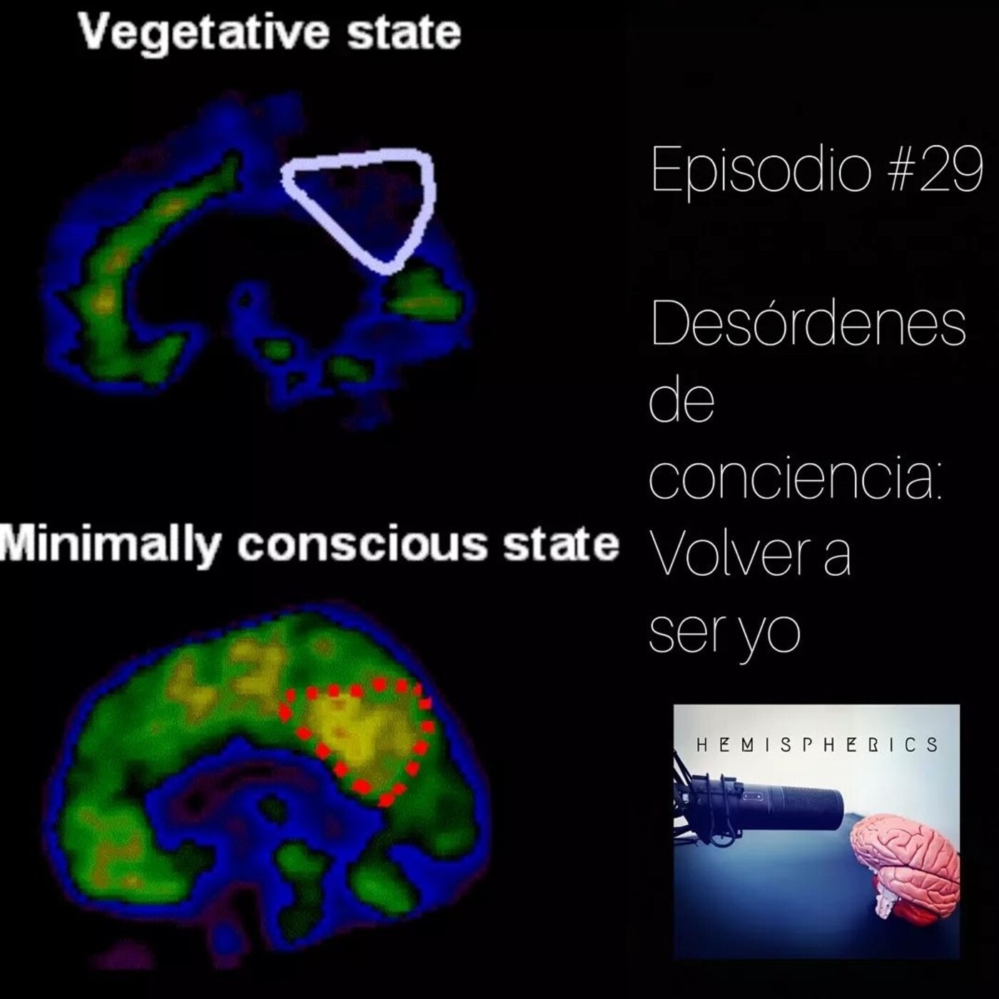 Hemispherics