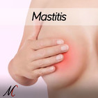 34. Mastitis