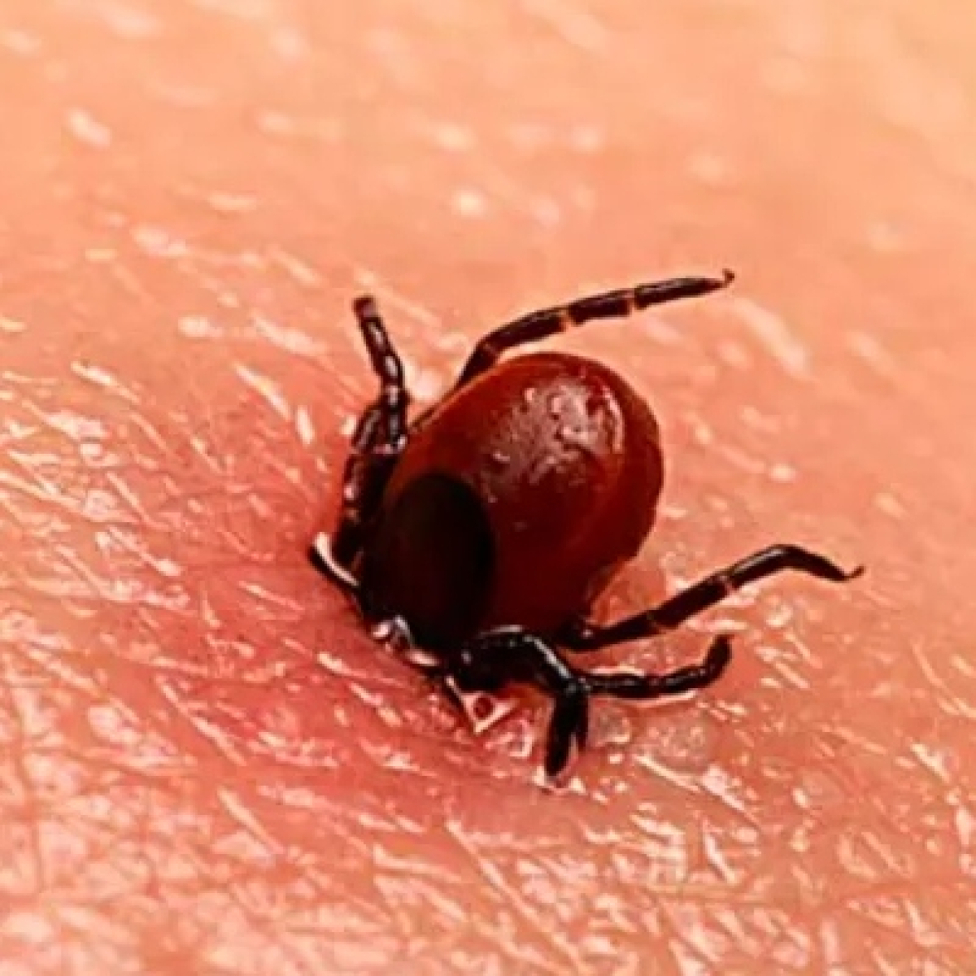 BORRELIOSIS o enfermedad de LYME, conflictos emocionales que la causan episode artwork