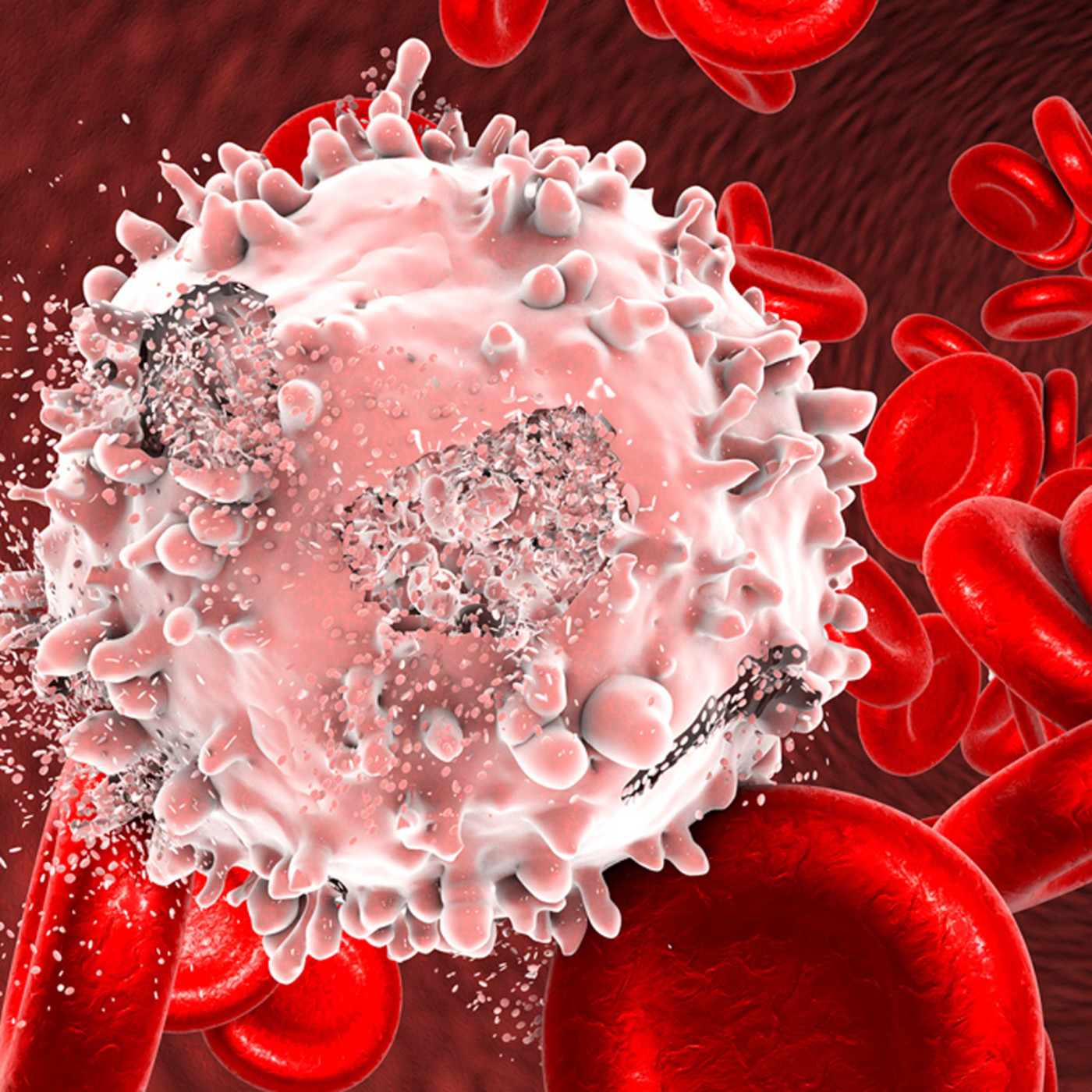 MESA DE ACTUALIDAD: La leucemia