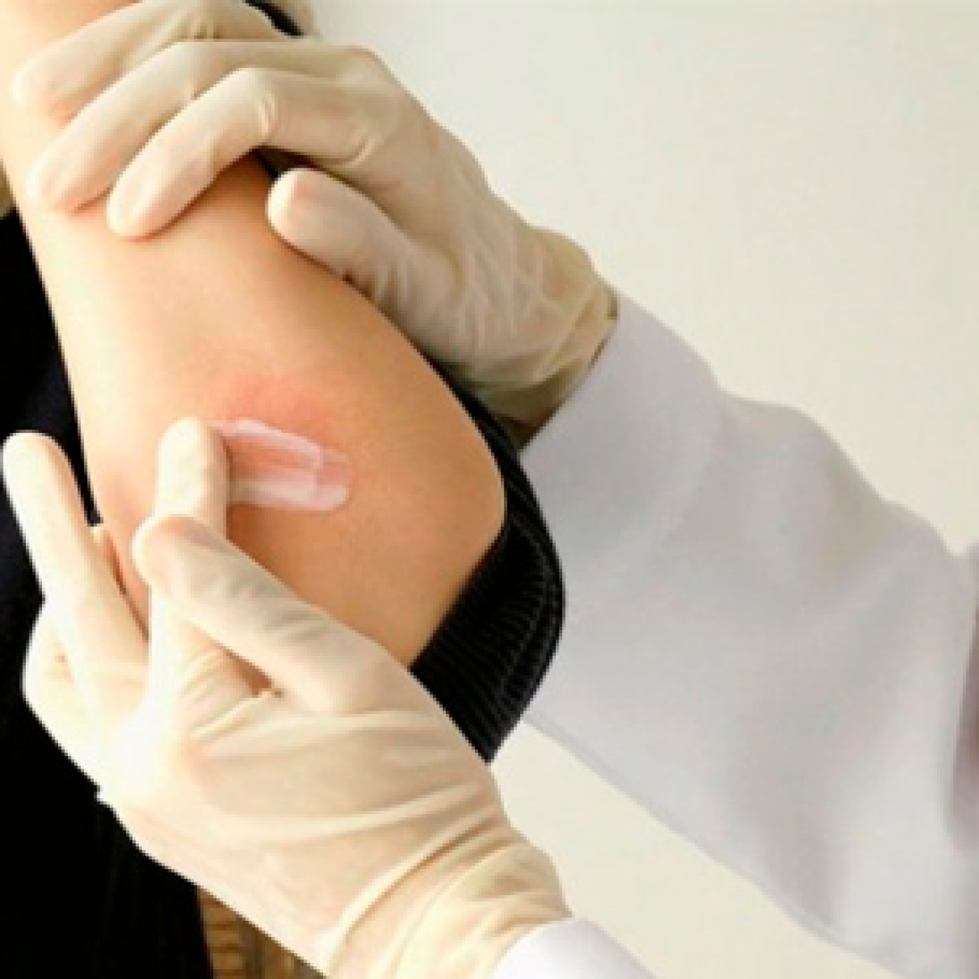 Psoriasis: una enfermedad de la piel más común de lo que piensas episode artwork