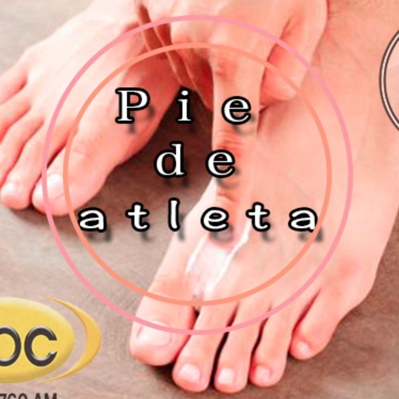 El Angel de tu Salud - PIE DE ATLETA episode artwork