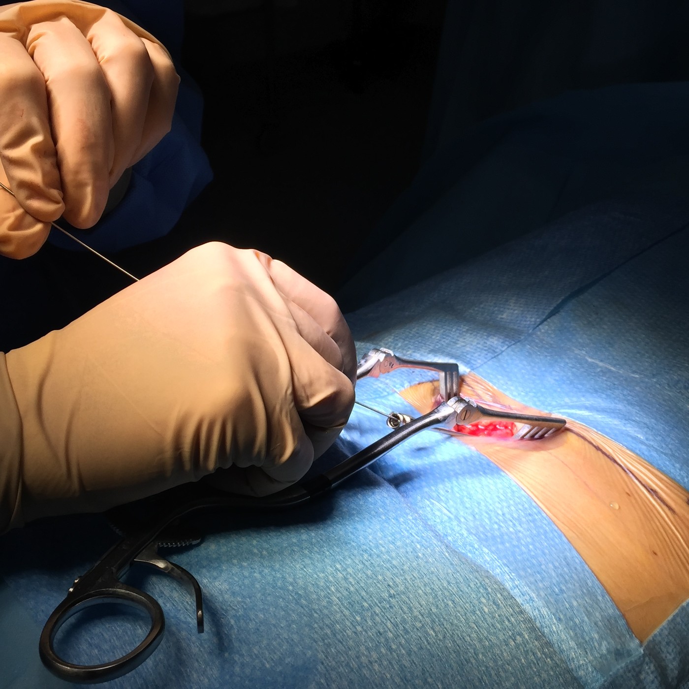 Rebélate contra el dolor