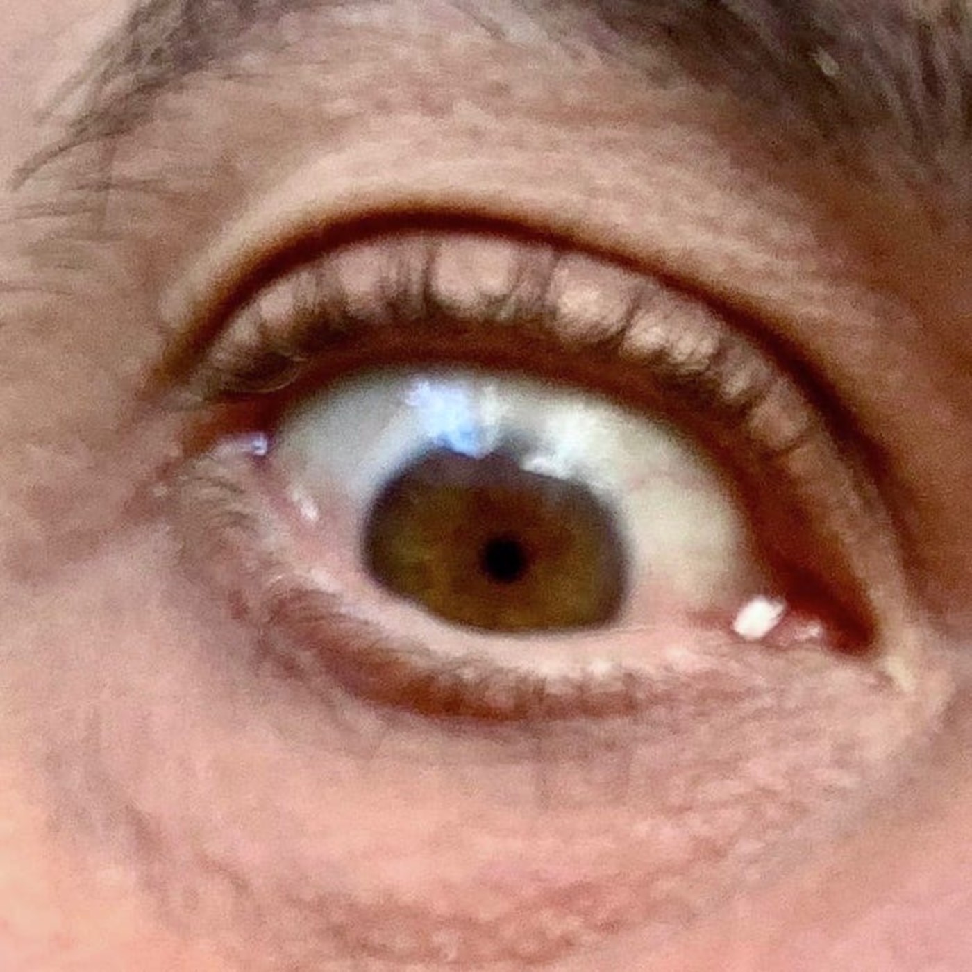 Ojo de Pez