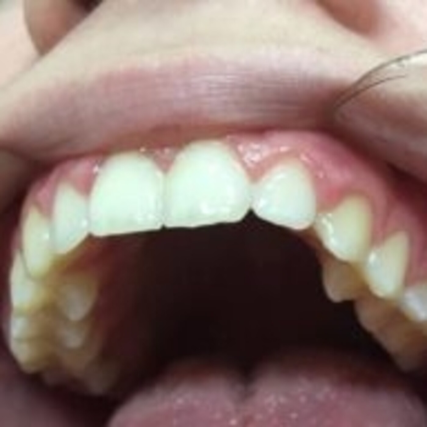 Salud Bucodental