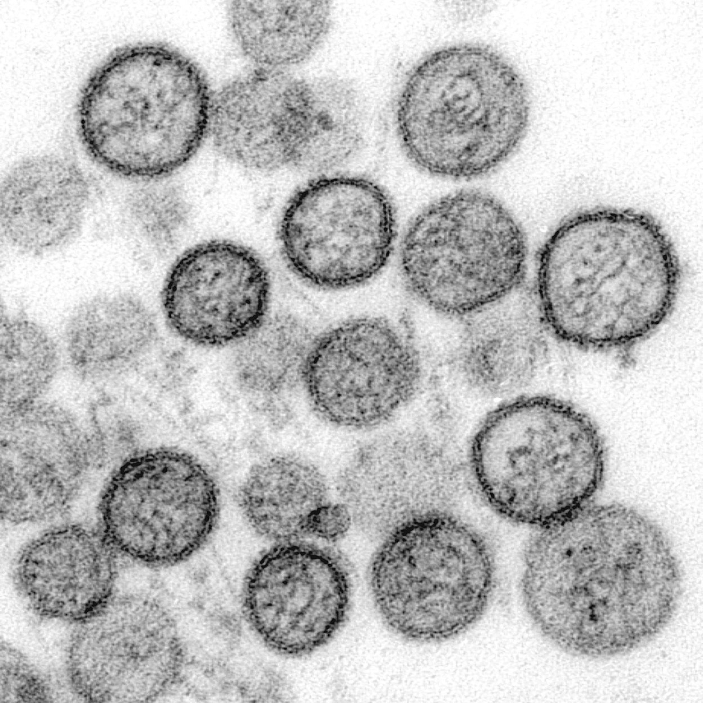 La Brújula de la Ciencia s15e14: Qué sabemos sobre el hantavirus de los Andes